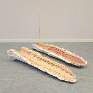 Se kadonnut ruumiinosa